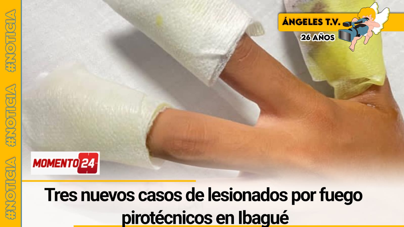 Tres nuevos casos de lesionados por fuego pirotécnicos - Angeles Television